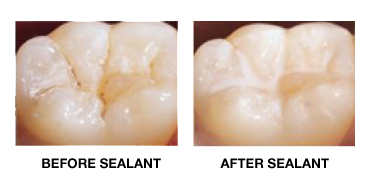 SEALANT-img SEALANT-img
