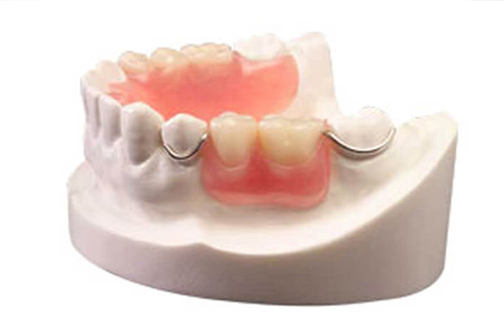 parital_dentures2