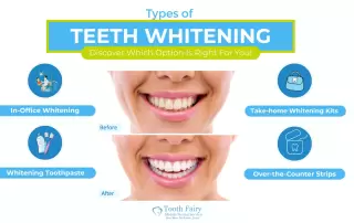 Tooth-Types of teeth