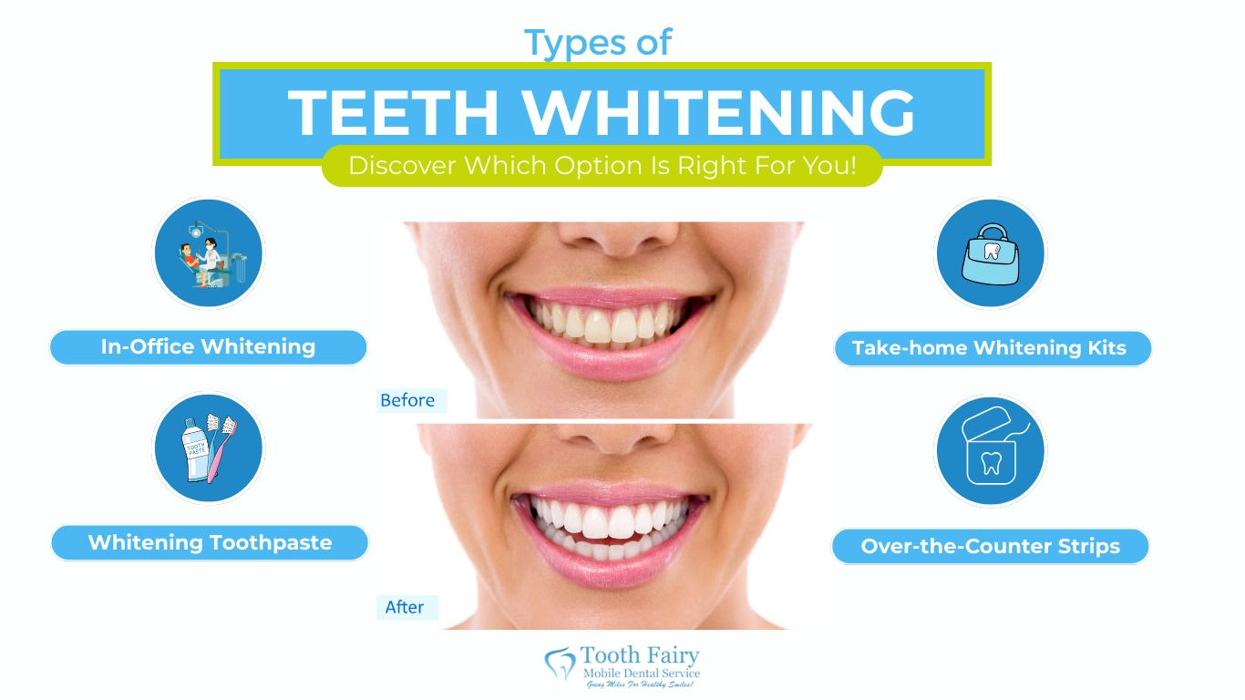 Tooth-Types of teeth