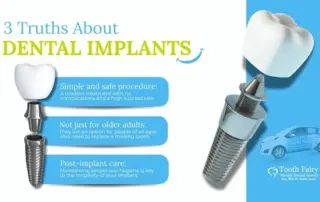 Dental Implants: The Long-Lasting Solution for Missing Teeth | Tooth Fairy Mobile Dental Services